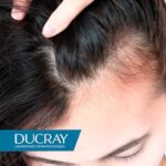 Ducray Creastim Reactiv Loción Anticaída 60 ML - Imagen 4